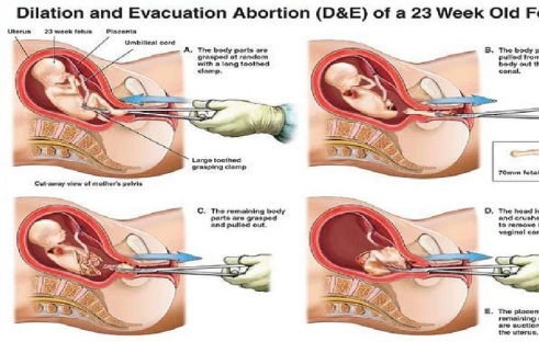 Kansas lawmaker: Abortion on par with Holocaust